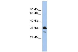 WB Suggested Anti-RAP1B Antibody Titration: 0. (RAP1B anticorps  (N-Term))