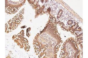 IHC analysis of CDK5 using anti-CDK5 antibody (ABIN6719393). (CDK5 anticorps  (AA 1-226))