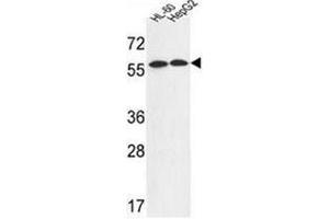 Western blot analysis of FANCC Antibody (C-term) in HL-60,HepG2 cell line lysates (35ug/lane). (FANCC anticorps  (C-Term))