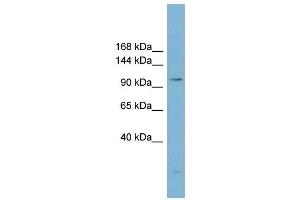 WB Suggested Anti-ACLY  Antibody Titration: 0. (ACLY anticorps  (Middle Region))
