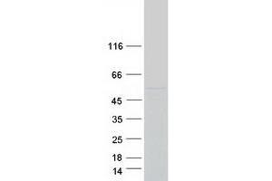 Validation with Western Blot