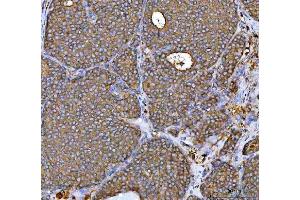 IHC analysis of MRPS22 using anti-MRPS22 antibody (ABIN7600613). (MRPS22 anticorps  (AA 21-329))
