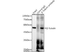 Immunoprecipitation analysis of 300 μg extracts of 293T cells using 3 μg β-Tubulin antibody (ABIN7271043). (TUBB anticorps)