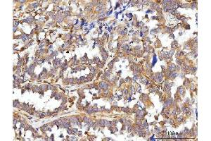 IHC analysis of CCDC115 using anti-CCDC115 antibody (ABIN7599042). (CCDC115 anticorps  (AA 1-180))