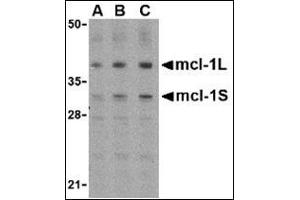 Western blot analysis of Mcl-1 in Raji cell lysates with AP30549PU-N (IN) at (A) 0. (MCL-1 anticorps  (Center))