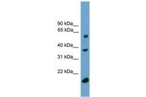 Image no. 1 for anti-Transducin (Beta)-Like 1, Y-Linked (TBL1Y) (C-Term) antibody (ABIN6744913) (TBL1Y anticorps  (C-Term))