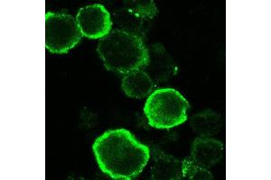 Immunofluorescence (IF) image for anti-HHV6 gQ1 (AA 3-422) antibody (ABIN2452012) (HHV6 gQ1 (AA 3-422) anticorps)