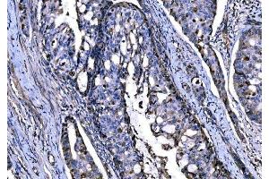 IHC analysis of KPNA2 using anti-KPNA2 antibody (ABIN7601936).