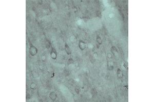 IHC on rat brain using Rabbit antibody to VPS45A  at a concentration of 10 µg/ml.