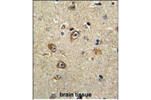 Formalin-fixed and paraffin-embedded human brain tissue reacted with PTK2 Antibody (Center), which was peroxidase-conjugated to the secondary antibody, followed by DAB staining.