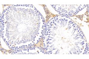 Detection of PZP in Rat Testis Tissue using Polyclonal Antibody to Pregnancy Zone Protein (PZP)
