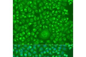 Immunofluorescence analysis of U2OS cells using IFNW1 Polyclonal Antibody at dilution of 1:100. (IFNW1 anticorps)
