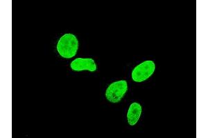Immunofluorescence of monoclonal antibody to TBX3 on HeLa cell.