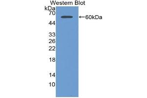 Western blot analysis of the recombinant protein. (AGGF1 anticorps  (AA 263-507))