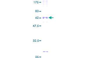 Image no. 1 for Retinal Outer Segment Membrane Protein 1 (ROM1) (AA 1-351) protein (GST tag) (ABIN1318440)