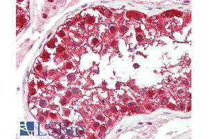 ABIN184570 (5µg/ml) staining of paraffin embedded Human Testis. (DDB1 anticorps  (C-Term))