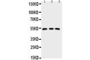 Anti-IRAK4 antibody, Western blotting Lane 1: HELA Cell Lysate Lane 2: U87 Cell Lysate Lane 3: MCF-7 Cell Lysate