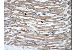 anti-Distal-Less Homeobox Protein 2 (DLX2) (N-Term) antibody