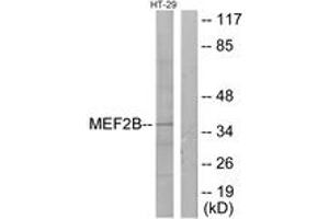 Western blot analysis of extracts from HT-29 cells, using MEF2B Antibody. (MEF2B anticorps  (AA 51-100))