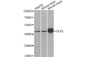 Western blot analysis of extracts of various cell lines, using DLK1 antibody. (DLK1 anticorps  (AA 83-383))