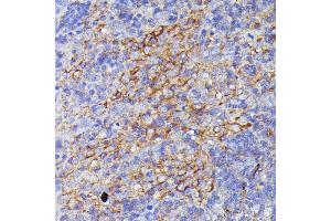 Immunohistochemistry of paraffin-embedded rat lymph node using SN antibody (ABIN7270670) at dilution of 1:100 (40x lens). (SNAP23 anticorps  (AA 1-211))