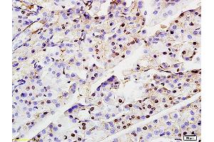 Formalin-fixed and paraffin embedded rat pancreas labeled with Anti-ASF1A Polyclonal Antibody, Unconjugated (ABIN703961) at 1:200 followed by conjugation to the secondary antibody and DAB staining (ASF1A anticorps  (AA 101-204))