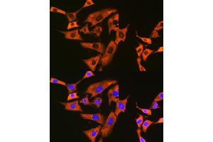 Immunofluorescence analysis of NIH-3T3 cells using UQCRFS1 Rabbit mAb (ABIN7271127) at dilution of 1:100 (40x lens). (UQCRFS1 anticorps)