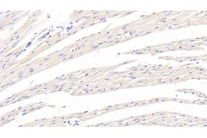 Detection of TGFb1 in Rat Cardiac Muscle Tissue using Monoclonal Antibody to Transforming Growth Factor Beta 1 (TGFb1)