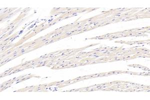 Detection of TGFb1 in Rat Cardiac Muscle Tissue using Monoclonal Antibody to Transforming Growth Factor Beta 1 (TGFb1) (TGFB1 anticorps  (AA 279-390))