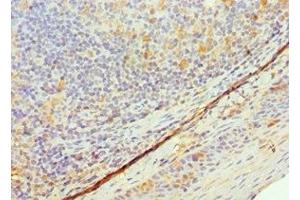 Immunohistochemistry of paraffin-embedded human tonsil tissue using ABIN7172113 at dilution of 1:100 (TK1 anticorps  (AA 1-234))