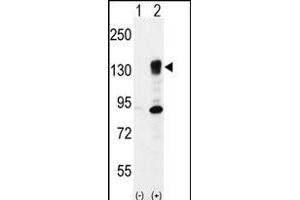 Western blot analysis of ITGA5 (arrow) using rabbit polyclonal ITGA5 Antibody (Center) (ABIN656138 and ABIN2845477). (ITGA5 anticorps  (AA 575-602))