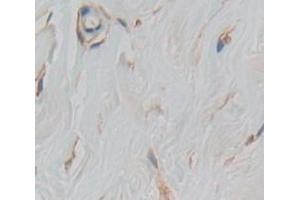 IHC-P analysis of Human Tissue, with DAB staining. (TLR5 anticorps  (AA 303-514))