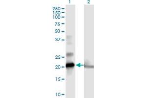 Western Blot analysis of COMMD1 expression in transfected 293T cell line by COMMD1 MaxPab polyclonal antibody. (COMMD1 anticorps  (AA 1-190))