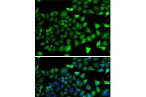 Immunofluorescence analysis of A-549 cells using NFYB Polyclonal Antibody (NFYB anticorps)