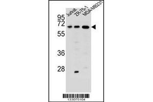 Western blot analysis in Jurkat,ZR-75-1,MDA-MB231 cell line lysates (35ug/lane). (ZSCAN2 anticorps  (N-Term))