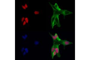 ABIN6263544 and ABIN6266651 staining MCF-7 by IF/ICC.