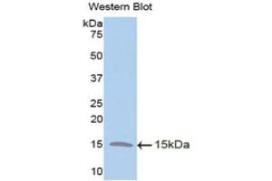 Western Blotting (WB) image for anti-Trefoil Factor 2 (TFF2) (AA 27-128) antibody (ABIN1173507) (Trefoil Factor 2 anticorps  (AA 27-128))