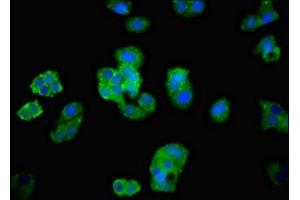 Immunofluorescent analysis of HepG2 cells using ABIN7143381 at dilution of 1:100 and Alexa Fluor 488-congugated AffiniPure Goat Anti-Rabbit IgG(H+L)