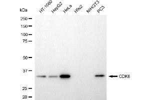 Western blotting analysis using CDK6 antibody (ABIN7798219).