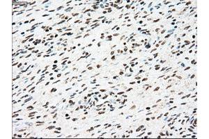 Image no. 7 for anti-Sjogren Syndrome Antigen B (SSB) antibody (ABIN1501146)