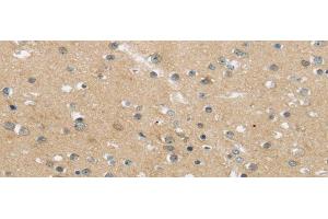 Immunohistochemistry of paraffin-embedded Human brain using MPP6 Polyclonal Antibody at dilution of 1/25