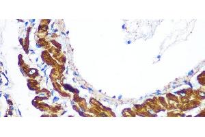 Immunohistochemistry of paraffin-embedded Rat lung using YTHDF2 Polyclonal Antibody at dilution of 1:100 (40x lens). (YTHDF2 anticorps)