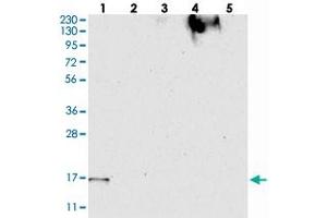 Western blot analysis of Lane 1: RT-4, Lane 2: U-251 MG, Lane 3: Human Plasma, Lane 4: Liver, Lane 5: Tonsil with FAM162A polyclonal antibody  at 1:250-1:500 dilution. (F162A anticorps)