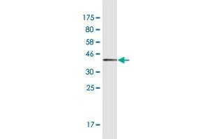 Western Blot detection against Immunogen (37. (HTRA3 anticorps  (AA 344-453))