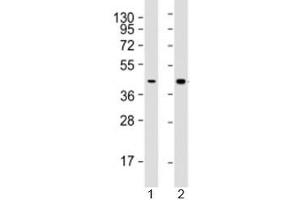 Western blot testing of human 1) HepG2 (liver carcinoma line) and 2) liver lysate with AGXT antibody at 1:2000. (AGXT anticorps  (AA 188-375))