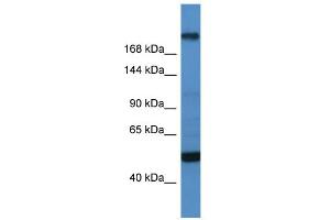 WB Suggested Anti-TCF20 Antibody Titration:  0.