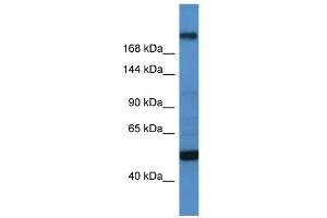 WB Suggested Anti-TCF20 Antibody Titration:  0. (TCF20 anticorps  (C-Term))