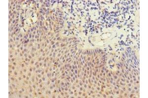 Immunohistochemistry of paraffin-embedded human tonsil tissue using ABIN7158638 at dilution of 1:100 (LY75/DEC-205 anticorps  (AA 440-680))