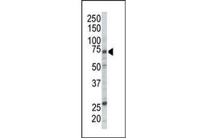 Western blot analysis of anti-RAF1 Pab (ABIN392261 and ABIN2841943) in Jurkat cell lysate.