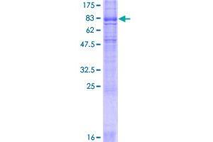 Image no. 1 for Solute Carrier Family 6 (Neurotransmitter Transporter, serotonin), Member 4 (SLC6A4) (AA 1-630) protein (GST tag) (ABIN1320509)
